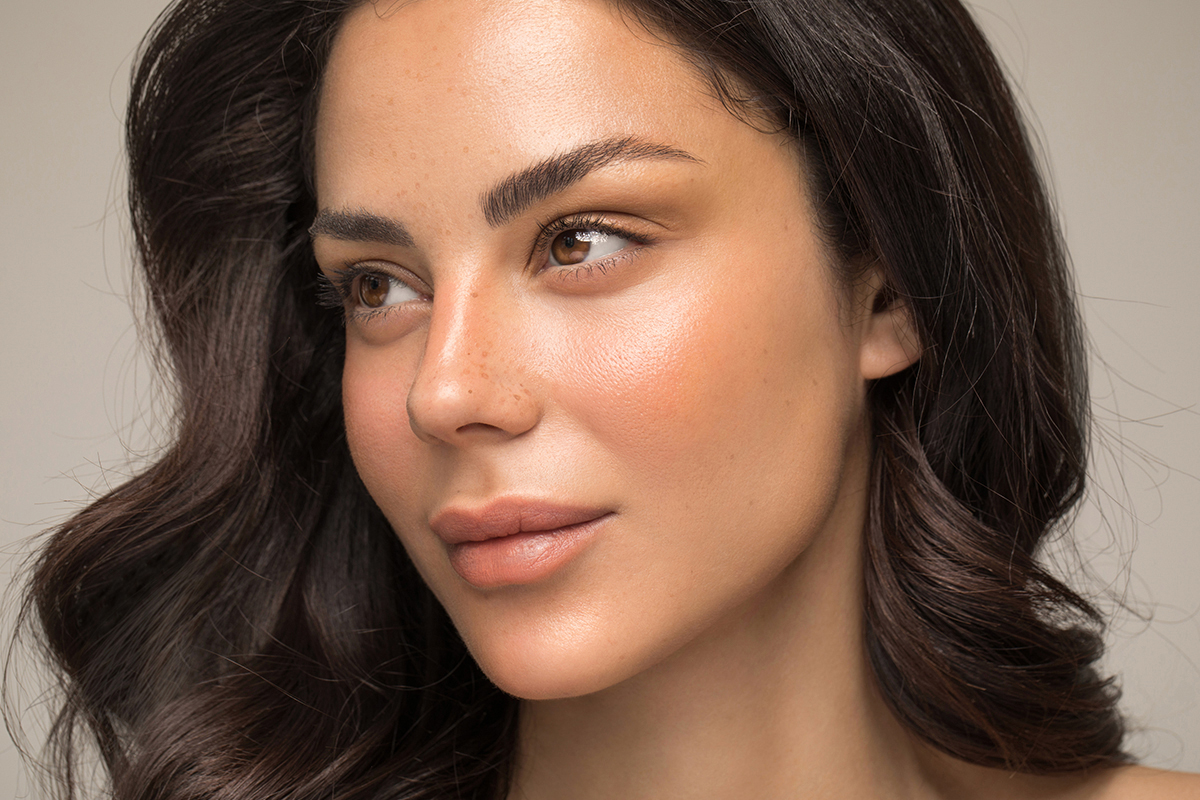 woman before Cheek augmentation surgery in Minneapolis